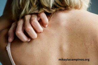 Managing Menopause Symptoms Effectively